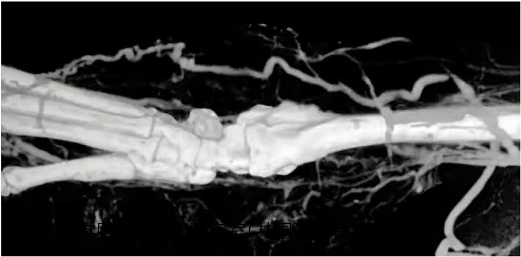 金ナノ粒子を使った造影検査
